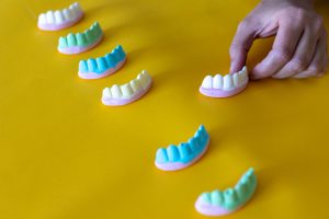 Como afectan las caries y el consumo de dulces a nuestra vida