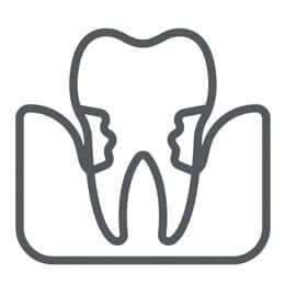 Periodoncia dental cliniques dentistes