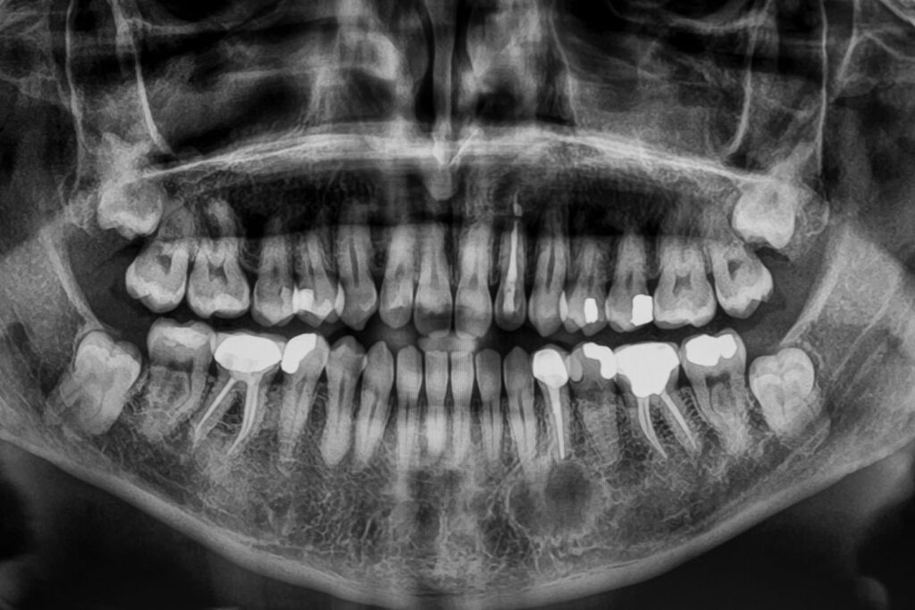 metodos de diagnostico odontologia