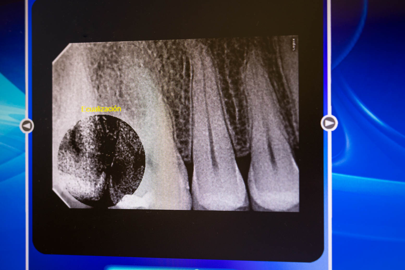 Herramientas de diagnóstico para la odontología